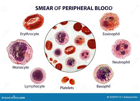 Evaluation of the peripheral blood smear .